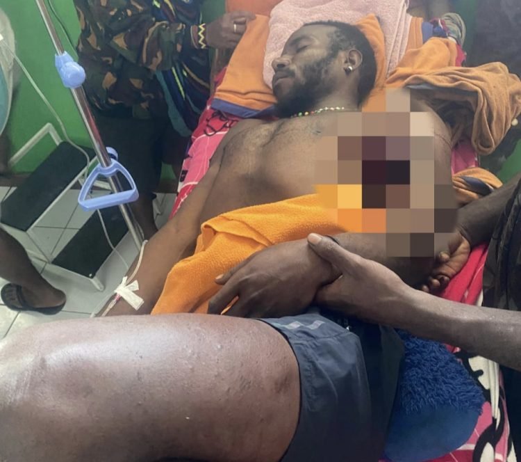 KKB Pimpinan Kalenak Murib Tembak Warga Sipil dan Bakar Honai di Puncak, Tiga Orang Meninggal Dunia